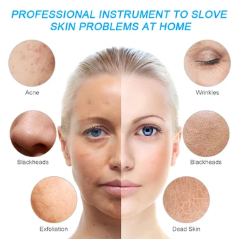 Ultralyd Facial Hud Skrubber Renere Ion Acne Hudorm Remover Peeling Skovl Renere Facial Massageapparat Hudpleje, Skønhed Værktøj