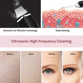 Ultralyd Ansigt Hud Skrubber Rengøring Maskine Facial Cleaner Fjerne Hudorm Pore Renere USB-Genopladelige hudpleje Værktøjer #R8