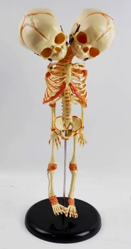 Baby ' s To-ledet Kraniet Menneskelige Nyfødte Baby Dobbelt Hoved Anatomi Kraniet Skelet Anatomiske Hjernen Uddannelse Anatomiske Undersøgelse Model
