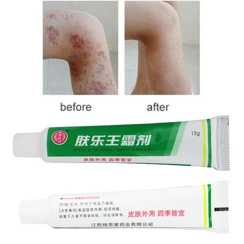 VIP 50STK FULEWANG (INGEN MAX) Hud Psoriasis Creme Dermatitis Eczematoid Eksem Salve Behandling af Psoriasis Creme 15g
